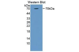 Detection of Recombinant C1qR1, Human using Polyclonal Antibody to Complement Component 1, Q Receptor (C1qR1) (CD93 Antikörper  (AA 227-493))