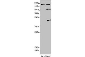 Western blot All lanes: MYO5B antibody at 1. (MYO5B Antikörper  (AA 1440-1690))