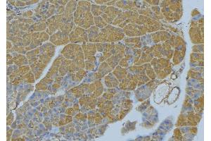 Immunohistochemistry (IHC) image for anti-Wingless-Type MMTV Integration Site Family, Member 10A (WNT10A) (N-Term) antibody (ABIN6266036)