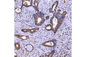 IHC analysis of TOM1L1 using anti-TOM1L1 antibody (ABIN7602631). (TOM1L1 Antikörper  (AA 9-448))