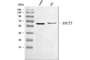 Western blot analysis of RNGTT using anti-RNGTT antibody (ABIN7599723).