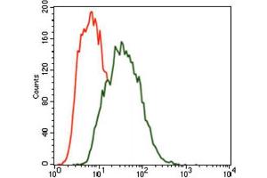 Immunohistochemical analysis of paraffin-embedded bladder cancer tissues using MARK3 antibody with DAB staining. (MARK3 Antikörper  (AA 435-658))