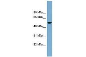Image no. 1 for anti-Solute Carrier Family 2 (Facilitated Glucose Transporter) Member 8 (SLC2A8) (AA 323-372) antibody (ABIN6743220) (SLC2A8 Antikörper  (AA 323-372))