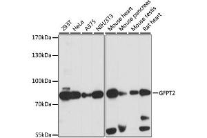 Western blot analysis of extracts of various cell lines, using GFPT2 antibody. (GFPT2 Antikörper)