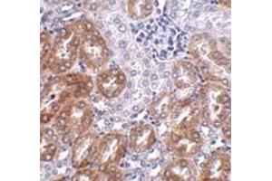Immunohistochemistry (IHC) image for anti-Ankyrin Repeat Domain 54 (ANKRD54) (C-Term) antibody (ABIN1030482) (ANKRD54 Antikörper  (C-Term))
