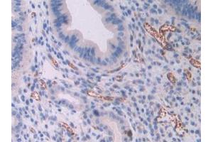 Immunohistochemistry (IHC) image for anti-Oncostatin M (OSM) (AA 116-205) antibody (ABIN7438130)