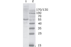 Western Blot testing using HIV-1 p24 antibody, clone 2N44 (05-007). (HIV-1 p24 Antikörper  (C-Term))