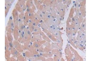 Detection of MYLK2 in Mouse Heart Tissue using Polyclonal Antibody to Myosin Light Chain Kinase 2 (MYLK2)