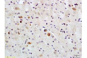 Formalin-fixed and paraffin embedded rat brain tissue labeled with Rabbit Anti-PACAP-38 Polyclonal Antibody  , Unconjugated at 1:200 followed by conjugation to the secondary antibody and DAB staining. (PACAP-38 Antikörper  (AA 31-38))