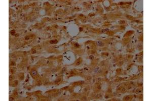 IHC image of ABIN7127348 diluted at 1:100 and staining in paraffin-embedded human liver tissue performed on a Leica BondTM system. (Rekombinanter ATF5 Antikörper)
