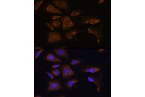 Immunofluorescence analysis of U-2 OS cells using RPS25 antibody (ABIN7270020) at dilution of 1:100. (RPS25 Antikörper  (C-Term))