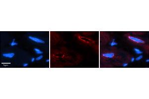 Rabbit Anti-TCF20 Antibody    Formalin Fixed Paraffin Embedded Tissue: Human Adult heart  Observed Staining: Nuclear (nuclear membrane) Primary Antibody Concentration: 1:100 Secondary Antibody: Donkey anti-Rabbit-Cy2/3 Secondary Antibody Concentration: 1:200 Magnification: 20X Exposure Time: 0. (TCF20 Antikörper  (C-Term))
