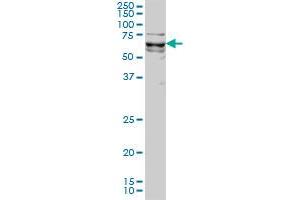 Western Blotting (WB) image for anti-Kruppel-Like Factor 11 (KLF11) (AA 404-513) antibody (ABIN599039) (KLF11 Antikörper  (AA 404-513))