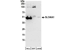 Western Blotting (WB) image for anti-Solute Carrier Family 46 (Folate Transporter), Member 1 (SLC46A1) (AA 225-275) antibody (ABIN7450740)
