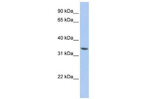 WB Suggested Anti-ZNF584 Antibody Titration:  0. (ZNF584 Antikörper  (Middle Region))