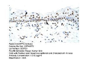 Rabbit Anti-SFPQ Antibody  Paraffin Embedded Tissue: Human Skin Cellular Data: Squamous epithelial cells Antibody Concentration: 4. (SFPQ Antikörper  (N-Term))
