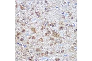 Immunohistochemistry (IHC) image for anti-ELAV (Embryonic Lethal, Abnormal Vision, Drosophila)-Like 4 (Hu Antigen D) (ELAVL4) (AA 1-366) antibody (ABIN7266914)