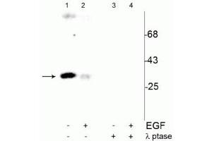 Western blot of human T47D cells showing specific immunolabeling of the ~34 kDa cdc2 phosphorylated at Tyr15 (Control, Lane 1). (CDK1 Antikörper  (pTyr15))