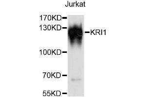 Western blot analysis of extracts of Jurkat cells, using KRI1 antibody (ABIN6294054) at 1:3000 dilution. (KRI1 Antikörper)