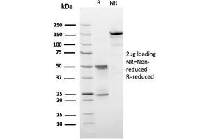 SDS-PAGE Analysis Purified HER-2 Monospecific Mouse Monoclonal Antibody (ERBB2/3257). (ErbB2/Her2 Antikörper  (AA 311-462))