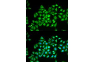 Immunofluorescence analysis of HeLa cells using ATP2A2 antibody. (ATP2A2 Antikörper)