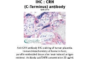 Image no. 1 for anti-Corticotropin Releasing Hormone (CRH) (C-Term) antibody (ABIN1733308) (CRH Antikörper  (C-Term))