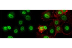 Immunofluorescence (IF) image for anti-O-Linked N-Acetylglucosamine (GlcNAc) Transferase (UDP-N-Acetylglucosamine:polypeptide-N-Acetylglucosaminyl Transferase) (OGT) antibody (ABIN2856718)