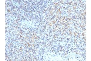Formalin-fixed, paraffin-embedded human Spleen stained with CD40 Ligand Mouse Monoclonal Antibody (CD40LG/2763). (CD40 Ligand Antikörper  (AA 108-261))