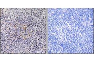 Immunohistochemistry (IHC) image for anti-X-Ray Repair Complementing Defective Repair in Chinese Hamster Cells 3 (XRCC3) (AA 41-90) antibody (ABIN2890031) (XRCC3 Antikörper  (AA 41-90))