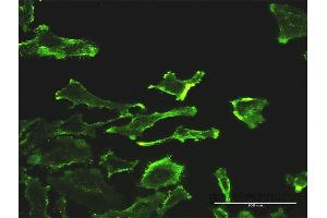 Immunofluorescence of monoclonal antibody to SH2D3C on HeLa cell. (SH2D3C Antikörper  (AA 1-703))