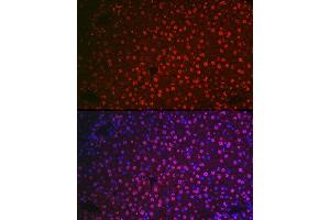 Immunofluorescence analysis of mouse liver cells using NR5 Rabbit pAb (ABIN6133574, ABIN6144832, ABIN6144834 and ABIN6217774) at dilution of 1:100 (40x lens). (NR5A2 + LRH1 Antikörper  (AA 1-140))
