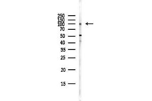 Western blot analysis of lysates from Hela cells(starvation,24h treatment), using THBD Antibody at 1/1000 dilution.
