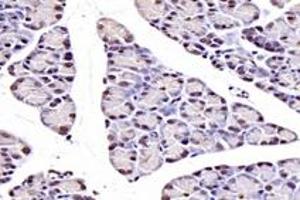 Immunohistochemistry analysis of paraffin-embedded rat pancreas using,NUDT22 (ABIN7074928) at dilution of 1: 7200 (NUDT22 Antikörper)