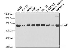 Western blot analysis of extracts of various cell lines using HAT1 Polyclonal Antibody at dilution of 1:1000. (HAT1 Antikörper)