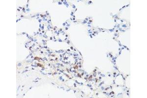 Immunohistochemistry of paraffin-embedded Rat lung using Phospho-MYC(S62) Polyclonal Antibody at dilution of 1:100 (40x lens). (c-MYC Antikörper  (pSer62))