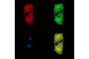 ABIN7095632 and ABIN7099694 staining  cells by IF/ICC. (ETF1 Antikörper)