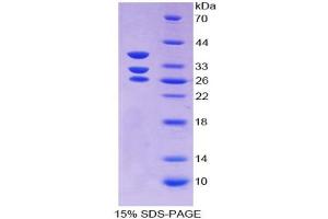 SDS-PAGE analysis of Mouse ICA1 Protein. (ICA1 Protein)