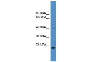 TIMP3 antibody used at 0. (TIMP3 Antikörper  (N-Term))