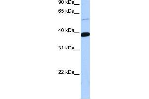 WB Suggested Anti-ZNF562 Antibody Titration:  0. (ZNF562 Antikörper  (Middle Region))