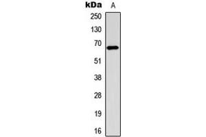 Western blot analysis of Estrogen Receptor alpha (pS106) expression in MCF7 EGF-treated (A) whole cell lysates. (Estrogen Receptor alpha Antikörper  (pSer106))