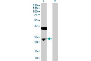 Western Blot analysis of BLVRB expression in transfected 293T cell line by BLVRB MaxPab polyclonal antibody. (BLVRB Antikörper  (AA 1-206))