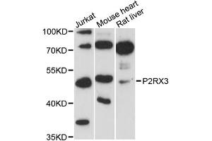 Western blot analysis of extracts of various cell lines, using P2RX3 antibody (ABIN6293509) at 1:3000 dilution.
