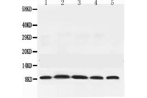 Western blot analysis of NEDD8 expression in rat testis extract ( Lane 1), mouse thymus extract ( Lane 2), mouse brain extract ( Lane 3), HELA whole cell lysates ( Lane 4) and MCF-7 whole cell lysates ( Lane 5). (NEDD8 Antikörper  (Middle Region))