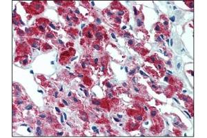 Immunohistochemistry (IHC) image for anti-Interleukin 23, alpha subunit p19 (IL23A) antibody (ABIN614363) (IL23A Antikörper)