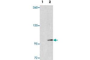 Western blot analysis of EPHA4 (arrow) using EPHA4 polyclonal antibody . (EPH Receptor A4 Antikörper  (AA 40-70))