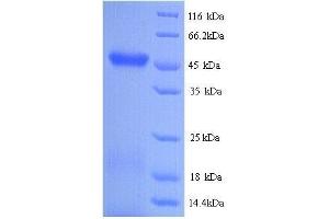 Conserved Protein, RTCB (RTCB) (AA 1-408), (full length) protein (His tag) (RTCB Protein (AA 1-408, full length) (His tag))