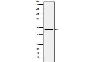 Western blot analysis of FRA2 expression in NCCIT cell lysate.