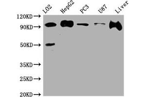 Western Blot Positive WB detected in: L02 whole cell lysate, HepG2 whole cell lysate, PC-3 whole cell lysate, U-87 whole cell lysate, Rat Liver whole cell lysate All lanes: ALIX antibody at 1:1000 Secondary Goat polyclonal to rabbit IgG at 1/50000 dilution Predicted band size: 97, 97, 31 kDa Observed band size: 97 kDa (Rekombinanter ALIX Antikörper)