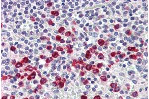 Human Spleen, Macrophages (formalin-fixed, paraffin-embedded) stained with MMP9 antibody ABIN337099 at 5 ug/ml followed by biotinylated anti-mouse IgG secondary antibody ABIN481714, alkaline phosphatase-streptavidin and chromogen. (MMP 9 Antikörper)