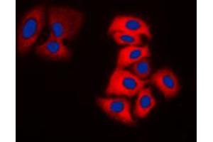 Immunofluorescent analysis of Tyrosine Hydroxylase staining in DLD cells. (Tyrosine Hydroxylase Antikörper  (N-Term))